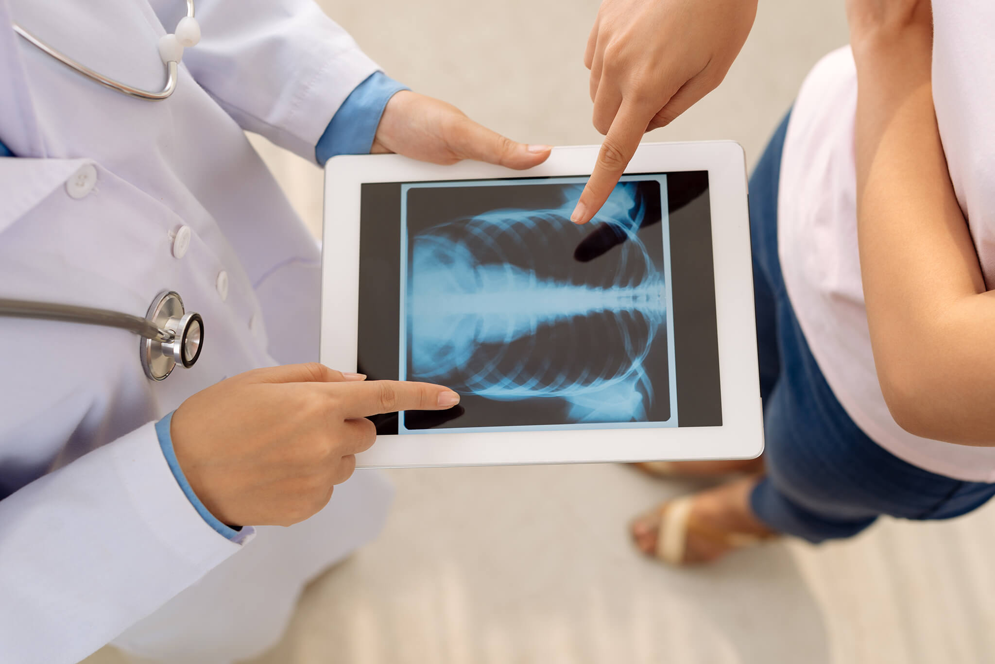 Dos personas observando y señalando una radiografía de tórax en una tableta.